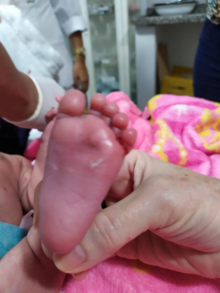 Bebê de 6 meses jogado em poço pelos pais era vítima de maus tratos em MT