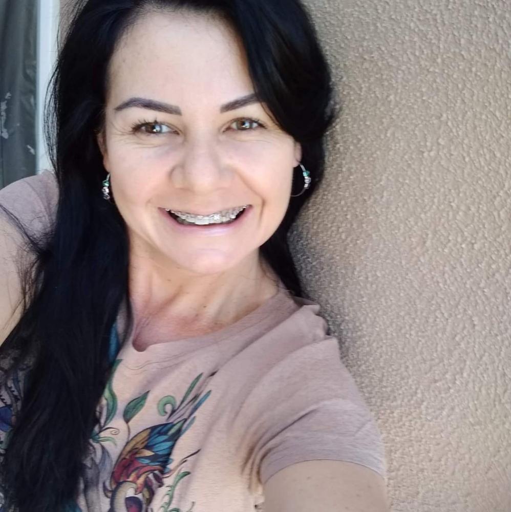 Mulher baleada no rosto na rua por policiais militares recebe alta em MT