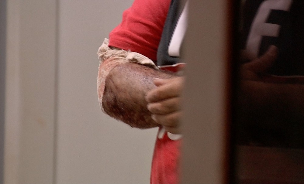 Mulher esfaqueia o namorado após ser agredida durante briga em MT