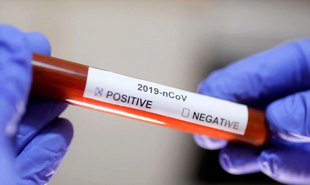 Mato Grosso registra 151 casos confirmados da Covid-19