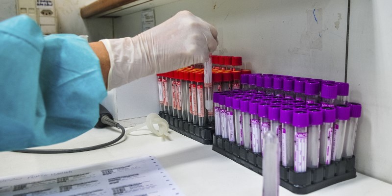 Covid-19: Câmara aprova projeto que incentiva doações para pesquisas