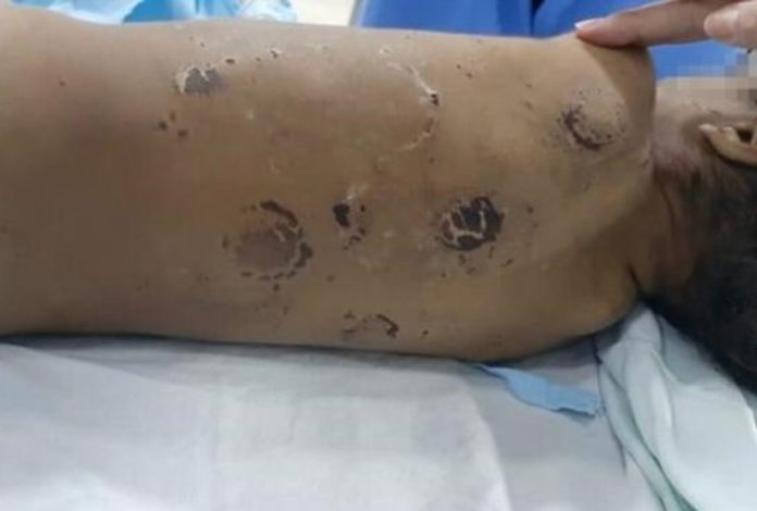 Criança de dois anos vai para UTI com as costelas quebradas pelos pais em Mato Grosso