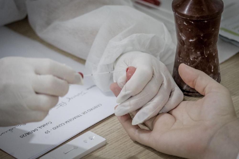 Mais de 24 mil testes foram enviados pelo Governo de Mato Grosso à região Norte