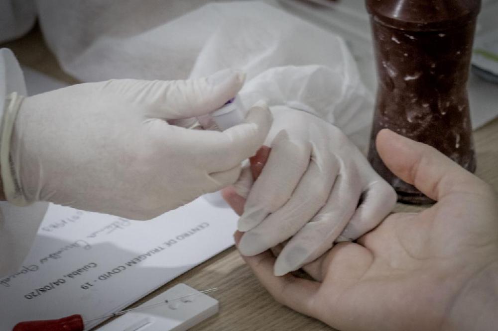 Região Sudeste recebeu 53,2 mil testes rápidos do Governo de Mato Grosso