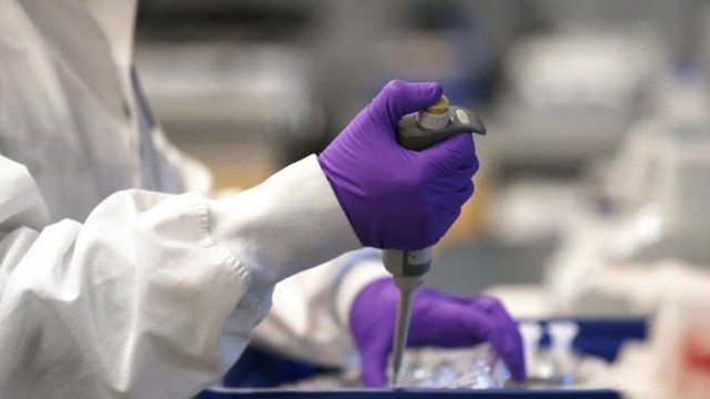 Vacinas contra a Covid-19 serão testadas em voluntários de Mato Grosso