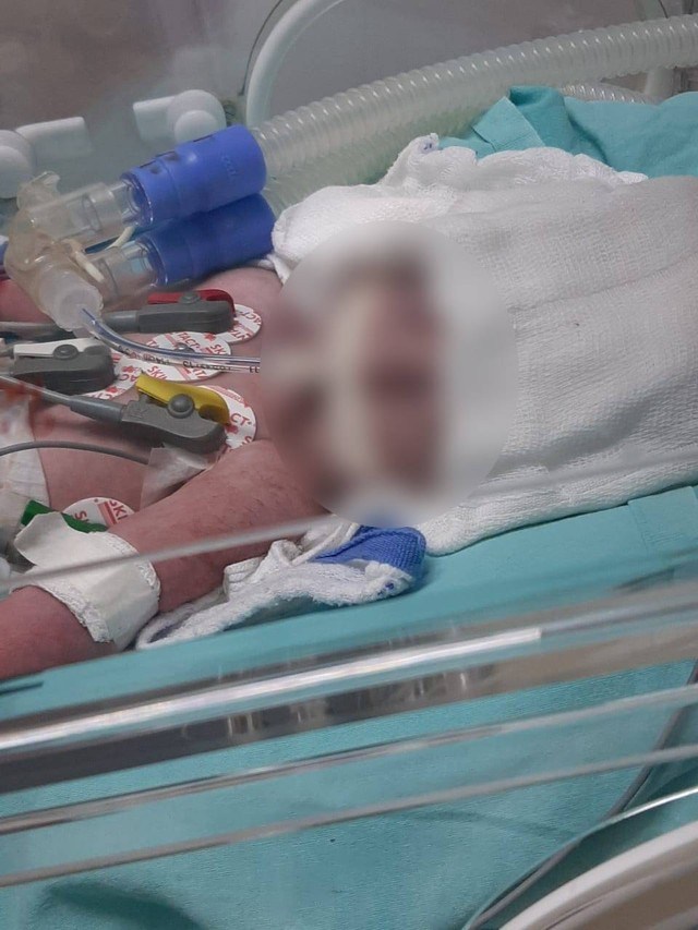 Bebê que teve couro cabeludo arrancado durante parto recebe alta depois de 43 dias internada em MT