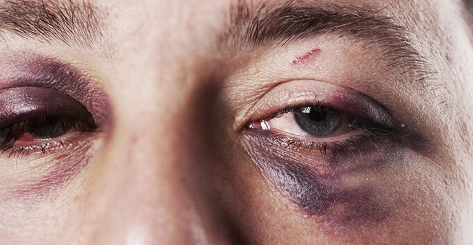 Marido apanha e é sequestrado pela esposa em Mato Grosso