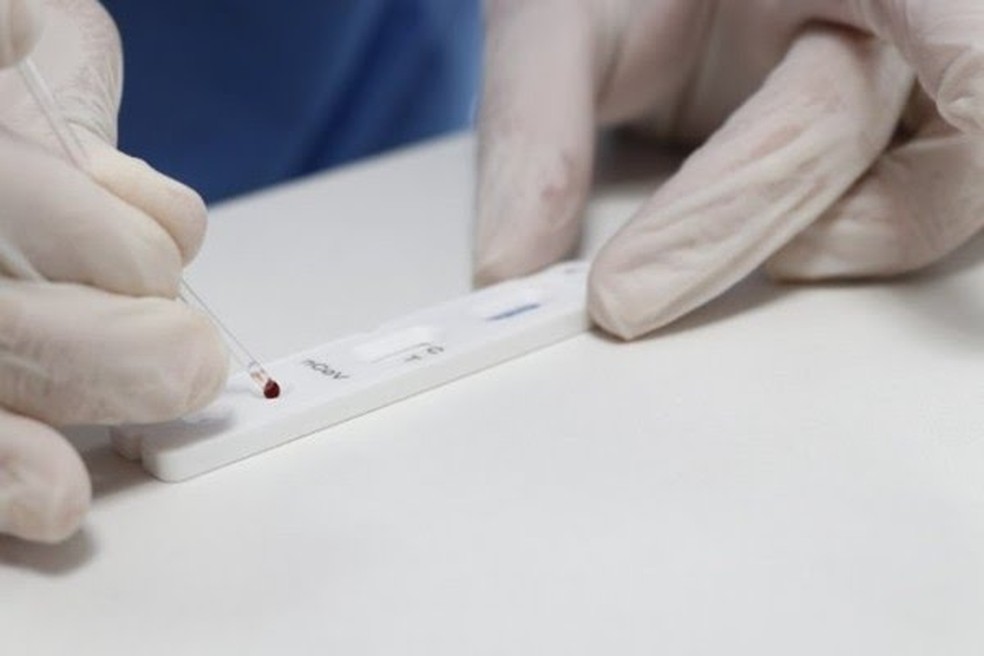 MT registra 1.061 novos casos de Covid-19 em 24 horas; total de mortes chega a 4.420